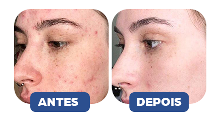 ANTES-E-DEPOIS-1.webp